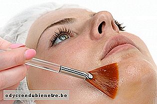 Tratamento com ácido mandélico para cicatriz de Acne