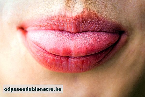 O que pode causar dor na língua
