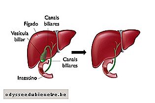 Fígado com e sem vesícula
