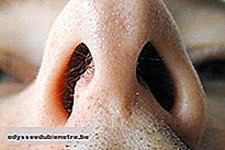 Desvio do septo nasal