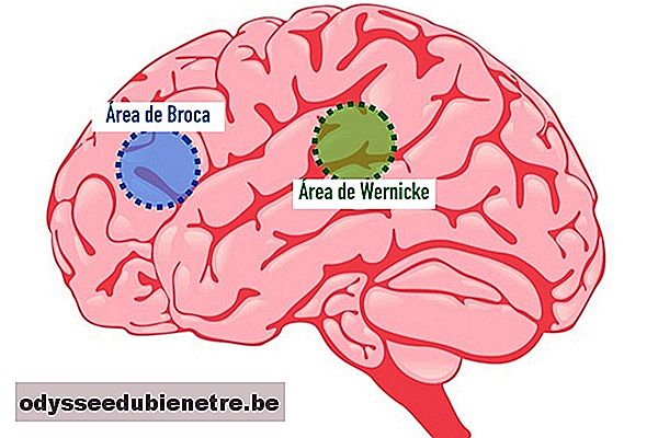 Áreas do cérebro que quando estão afetadas provocam afasia