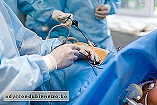 Cirurgia por laparoscopia