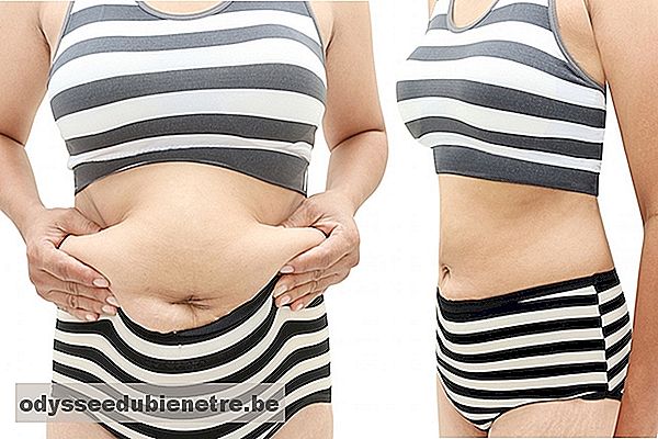 Antes e depois da abdominoplastia reparadora