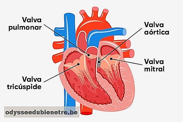 O que é cardiopatia congênita e principais tipos
