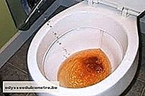 Urina cor coca-cola