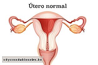 Aspecto do útero normal