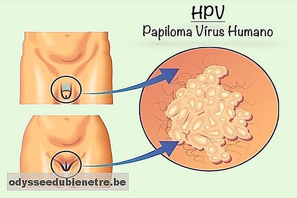 HPV tem cura?