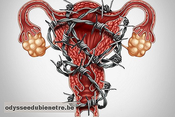 O que é endometriose profunda