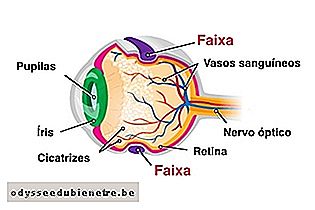 Colocação da faixa cirúrgica no olho