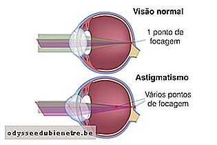 Olho no astigmatismo