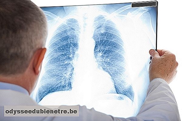 O que é Fibrose pulmonar e como tratar