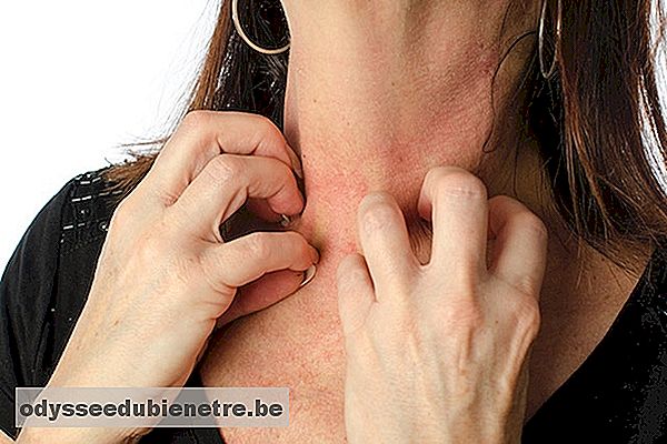 Quais são os sintomas que indicam dermatite atópica