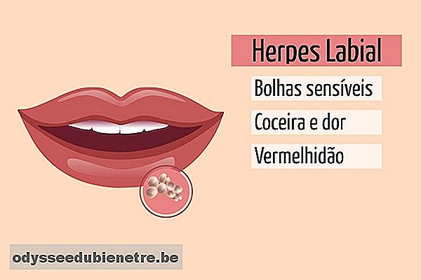 Sintomas de herpes na boca