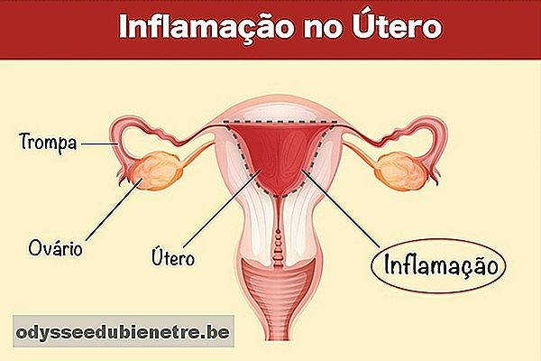 Sintomas de infecção no útero