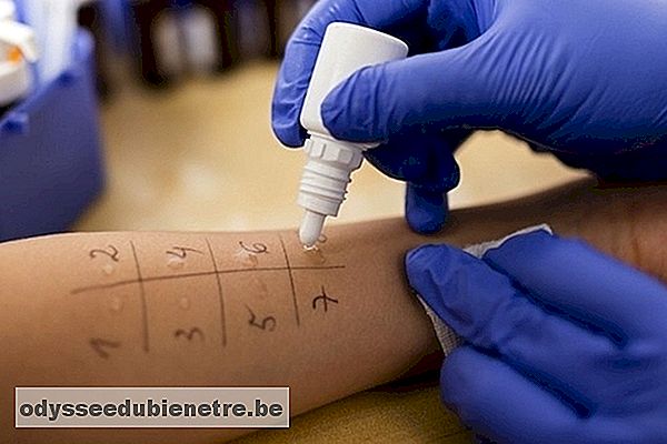 Teste de alergia na pele