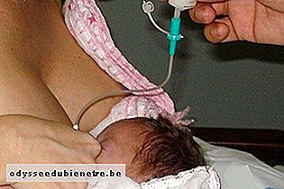 Translactação no bebê prematuro
