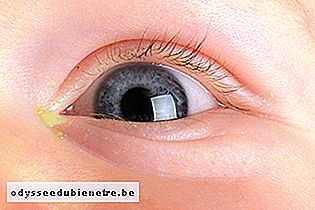 Secreção amarelada no olho do bebê