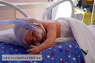 Bebê recém-nascido com CPAP nasal