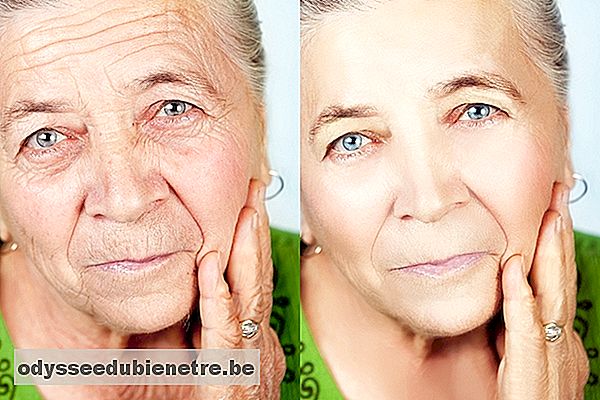 Antes e depois da cirurgia ao rosto