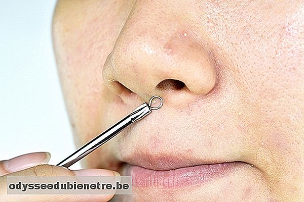 Como eliminar cravos e espinhas do nariz