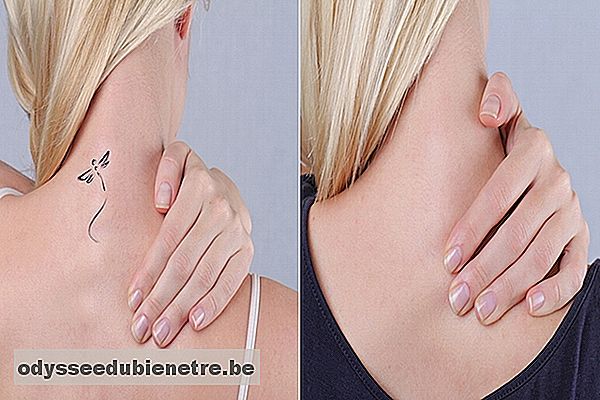 Como remover uma tatuagem definitiva ou de henna