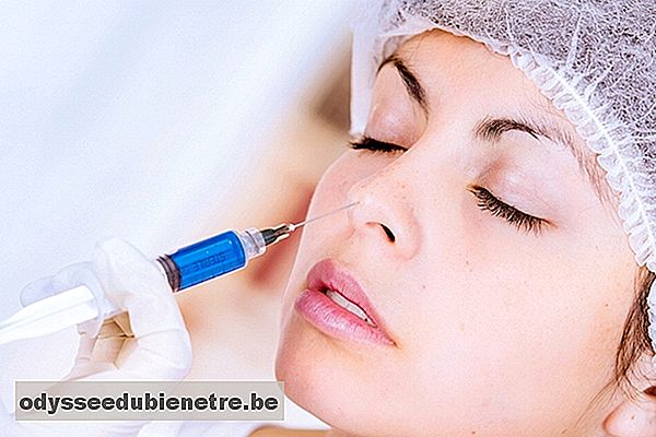 Bioplastia de nariz