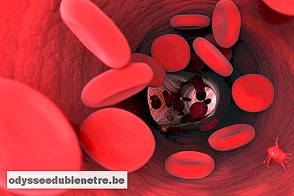 8 mitos e verdades sobre a hemofilia