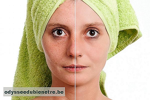 Antes e depois do tratamento com ácido retinóico
