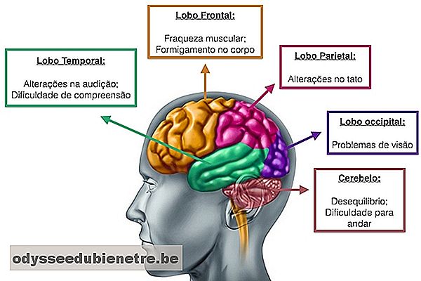 Principais sintomas de acordo com a localização do tumor cerebral