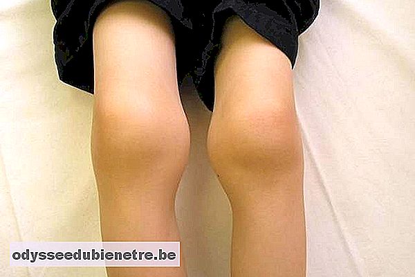 Atrofia muscular das pernas
