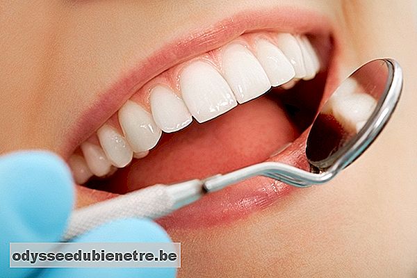 Melhores tratamentos para clarear os dentes