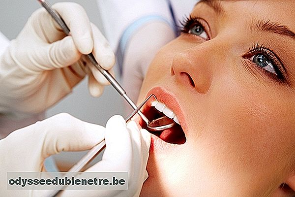 Como identificar e tratar a Cárie Dentária