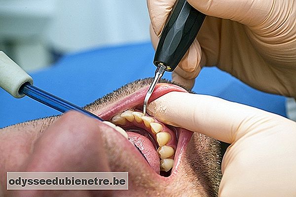 Tratamento para periodontite