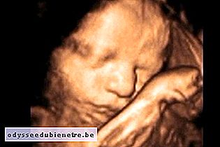 Desenvolvimento do bebê - 31 semanas de gestação
