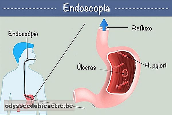 Como é feita a Endoscopia