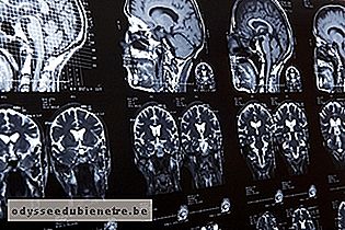 Tomografia computadorizada do crânio