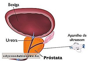 Biopsia da próstata