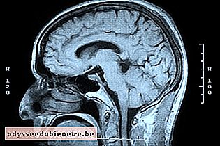 Imagem de ressonância magnética do crânio