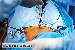 Cirurgia por laparoscopia