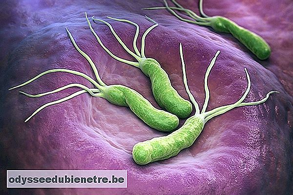 Como se pega e como tratar a bactéria H. pylori