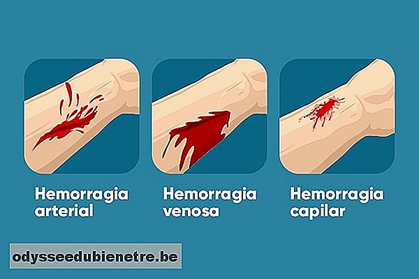 Como identificar os tipos de hemorragia