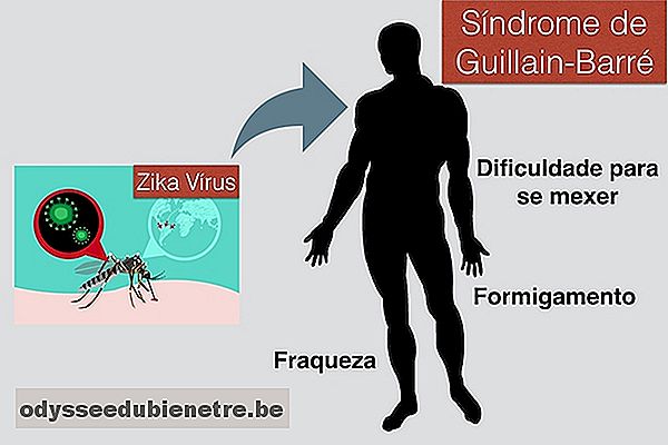 Zika pode causar Fraqueza e Paralisia nas Pernas