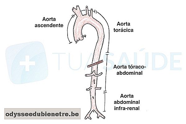 Diferentes regiões da aorta