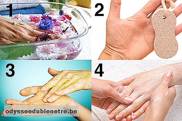 4 passos para remover Calos das Mãos