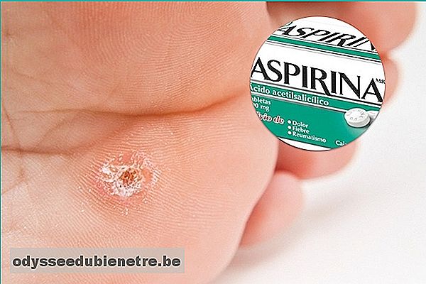 Como usar a Aspirina para remover Calos Secos 