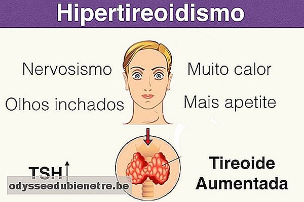 Como identifificar e Tratar o Hipertireoidismo