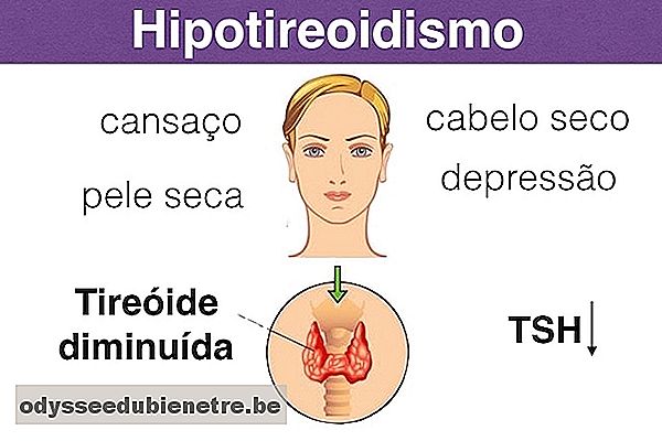 Como identificar e Tratar o Hipotireoidismo