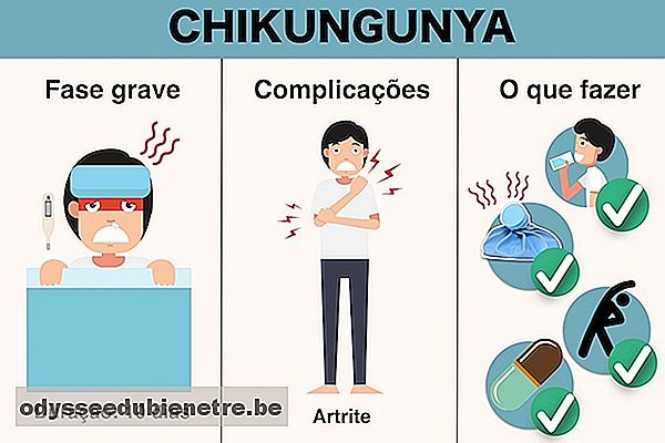 O que fazer para recuperar da Chikungunya