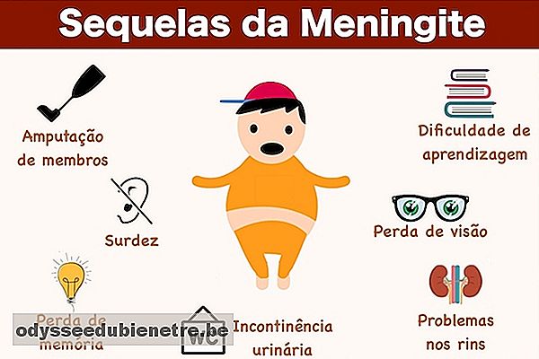 Saiba quais são as Sequelas da Meningite