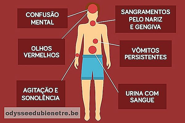 Sintomas da dengue hemorrágica